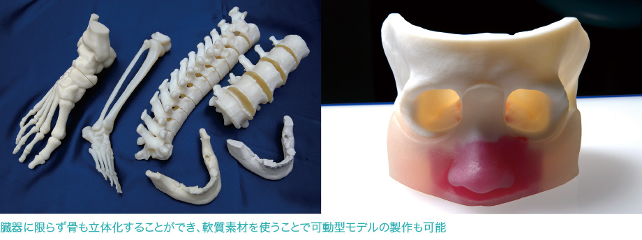 臓器に限らず骨も立体化することができ、軟質素材を使うことで可動型モデルの背栄作も可能